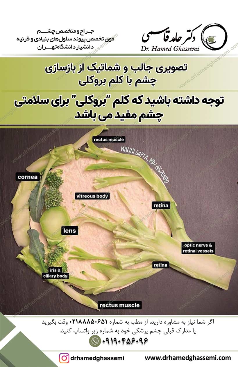 بازسازی شماتیک چشم با کلم بروکلی 