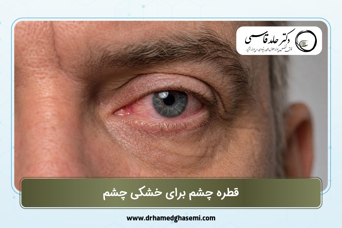 قطره چشم برای خشکی چشم