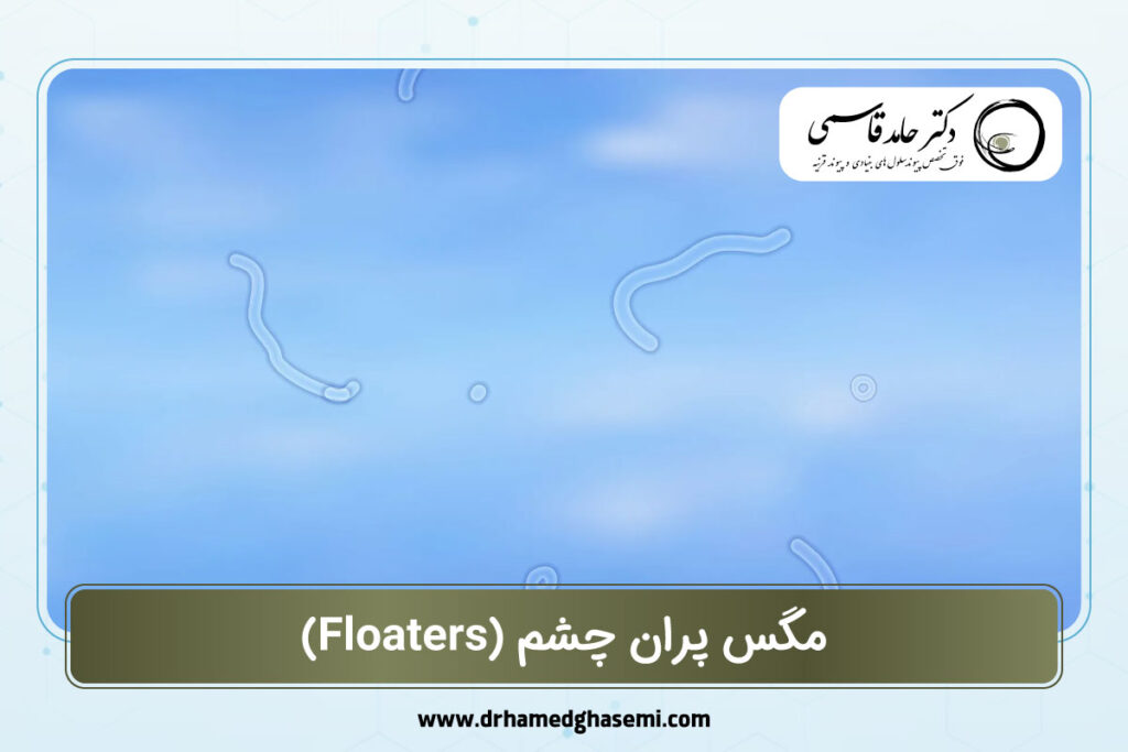 مگس پران چشم