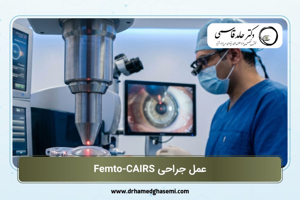 عمل جراحی فمتو CAIRS