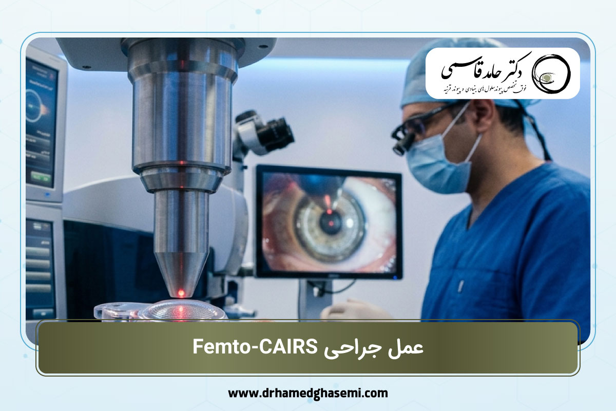 عمل جراحی فمتو CAIRS