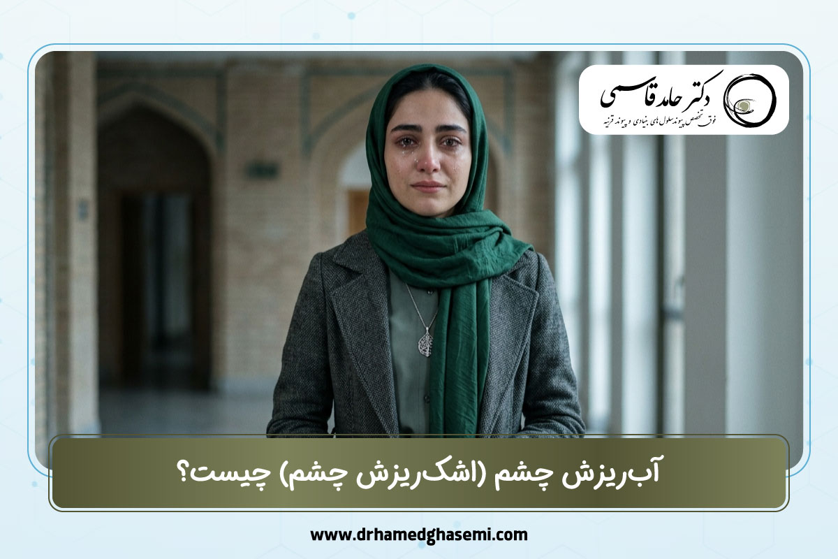 آب‌ریزش چشم