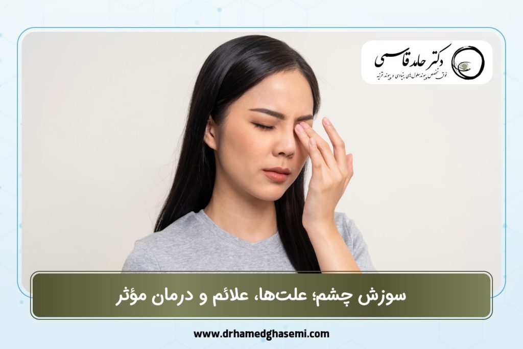 سوزش چشم؛ علت‌ها، علائم و درمان مؤثر