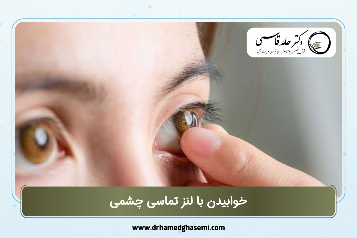 خوابیدن با لنز تماسی چشمی