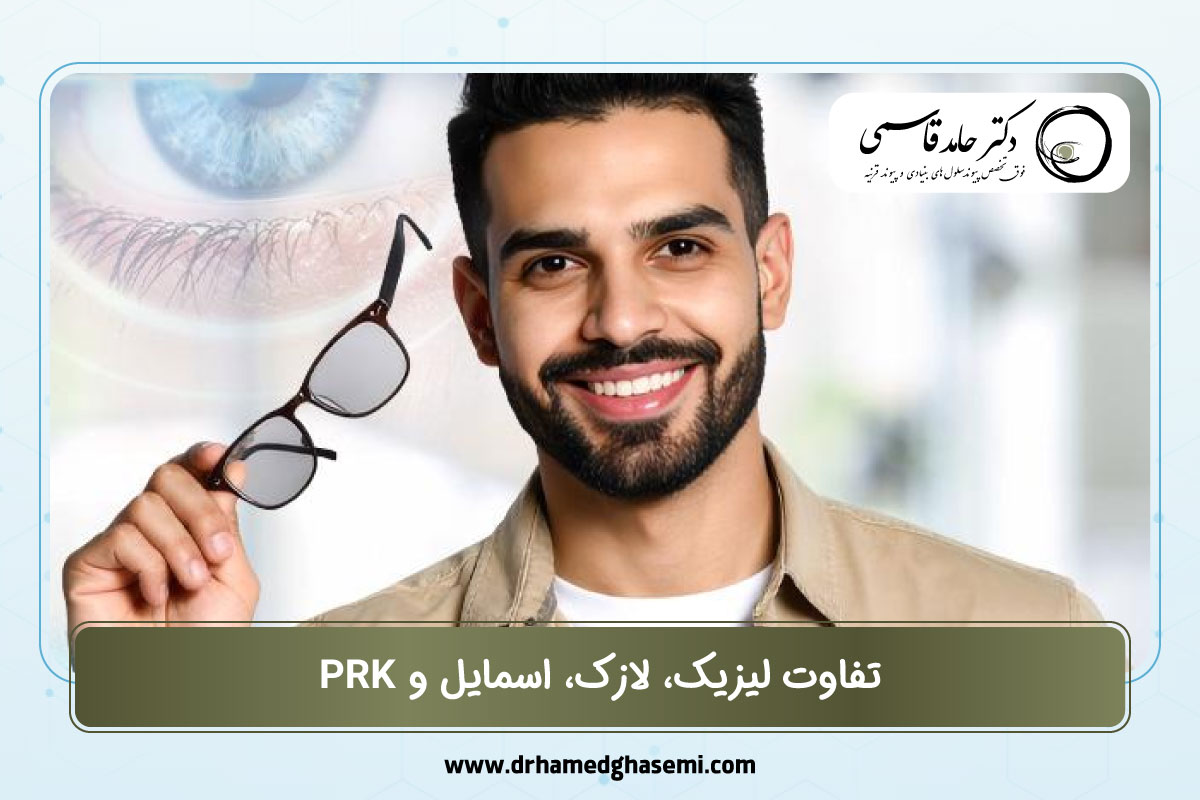 تفاوت لیزیک، لازک، اسمایل و PRK