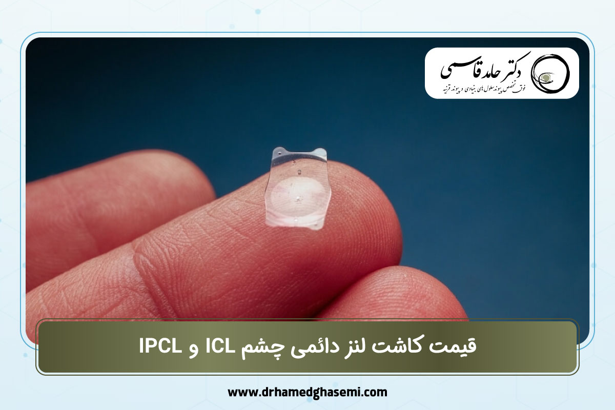 قیمت کاشت لنز دائمی چشم ICL و IPCL